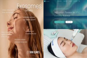Exosome Therapy for Skin Rejuvenation How It Works & Benefits